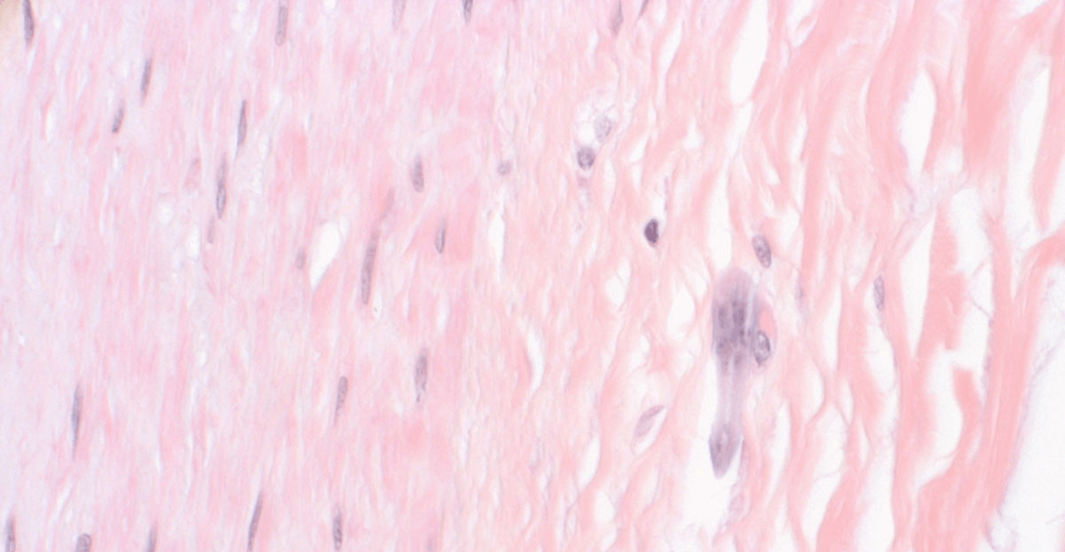 ATOPY AND GI CONNECTIONS Cont.