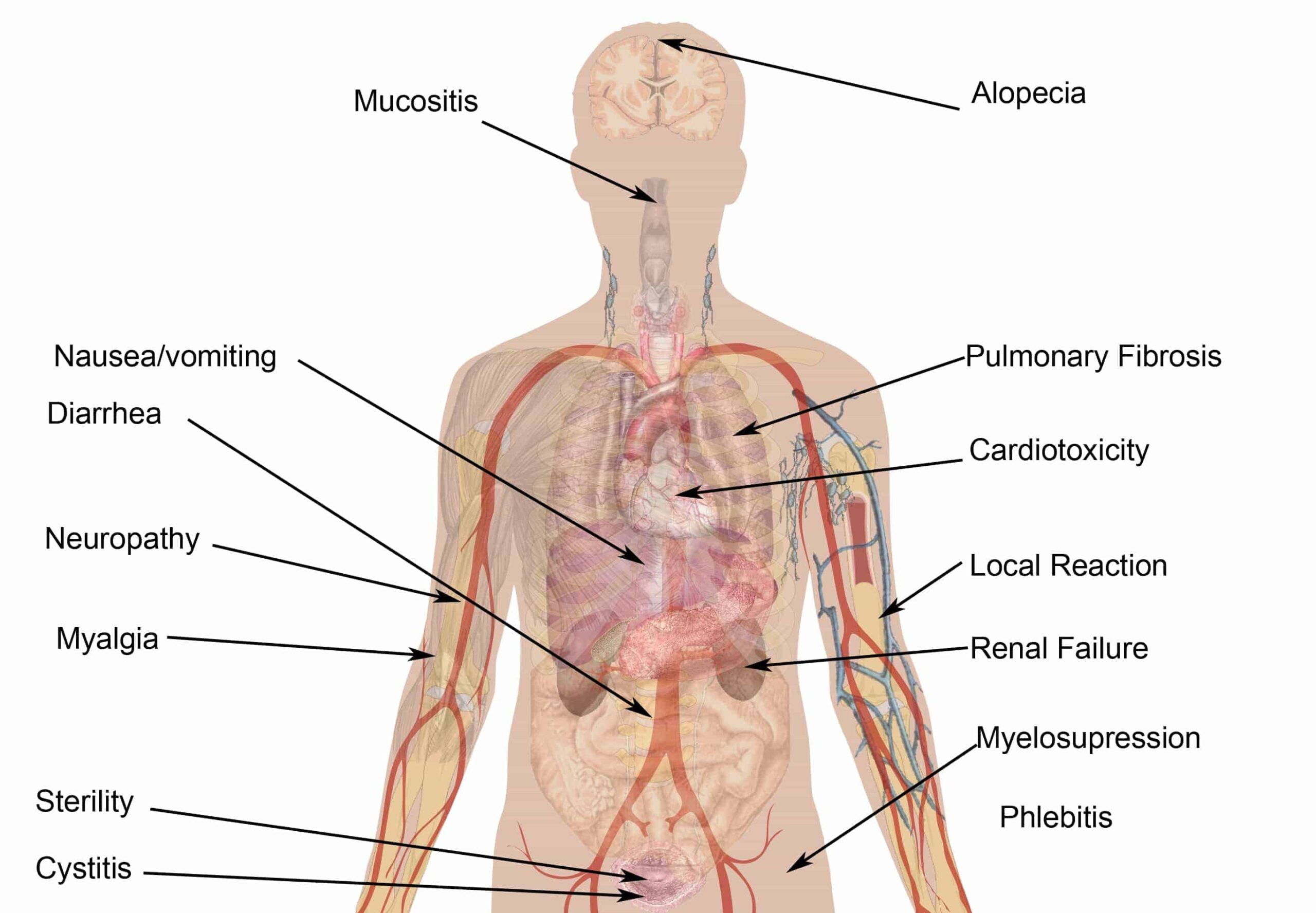 Cancer:  Integrative and Alternative therapies, what are they and do they work?